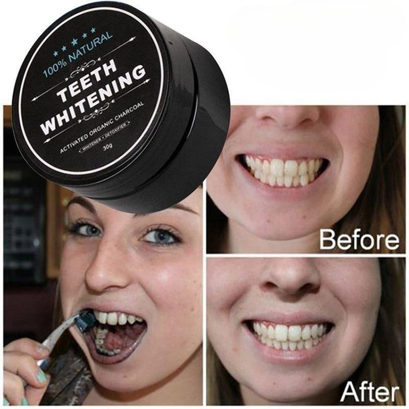 1 коробка порошка для отбелива – обзор и цена Activated Charcoal Powder